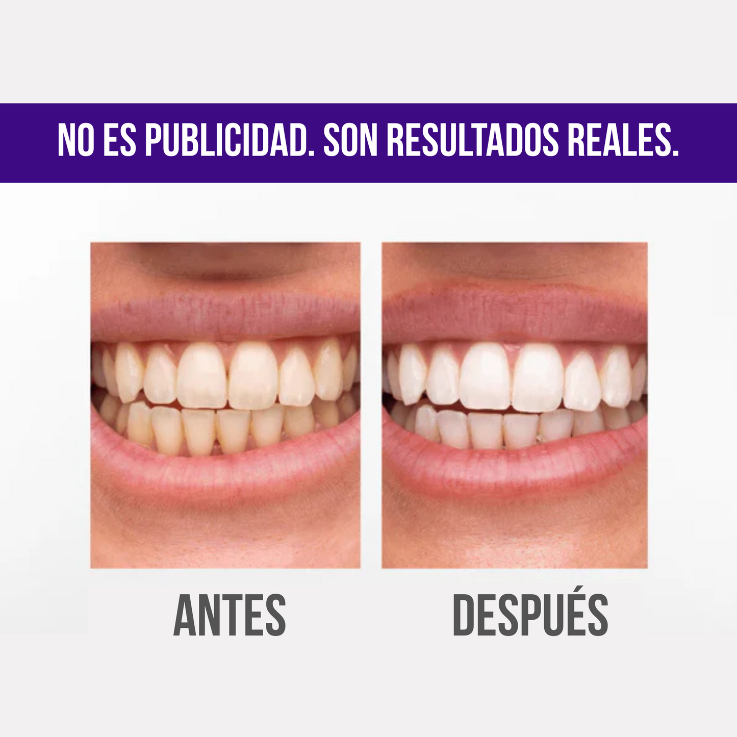Tiras Blanqueadoras InstantWhite